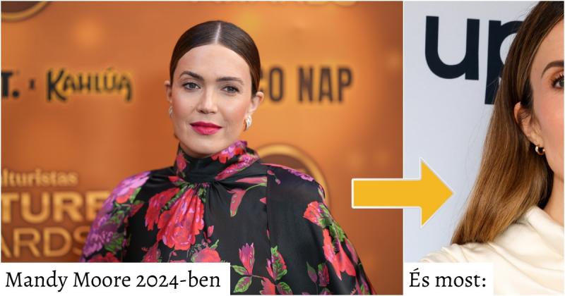 Mandy Moore külseje drámai változáson ment keresztül, ami sokakban felkeltette a kíváncsiságot és a megdöbbenést. A rajongók között heves viták robbantak ki arról, mi állhat a háttérben: vajon plasztikai műtétek, sminktrükkök vagy esetleg csak egy új stíl